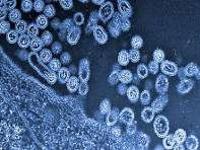 Vogelgrippeviren unter dem Mikroskop. Foto: Takeshi Noda, Universität Tokio